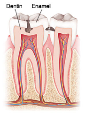 Patient Flossing