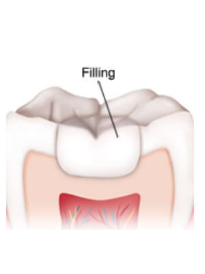 Patient Flossing